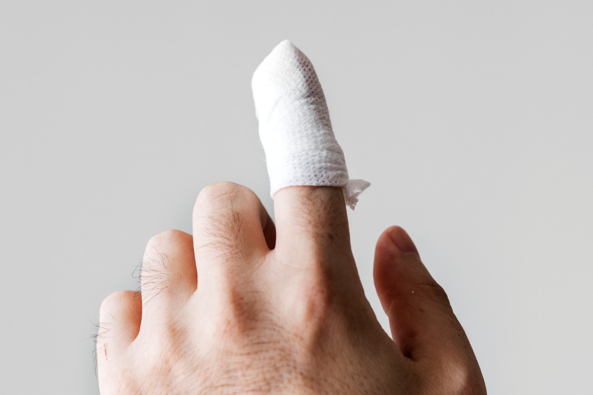 Złamany lub zerwany paznokieć – co zrobić w takim przypadku i jak go leczyć? 